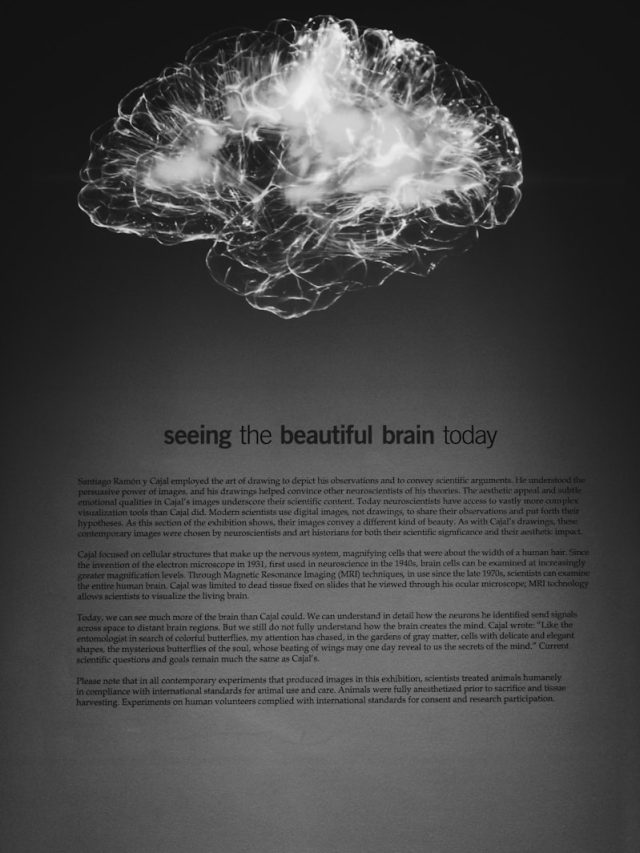 a black and white photo of a brain