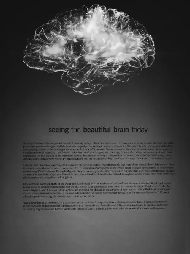 a black and white photo of a brain